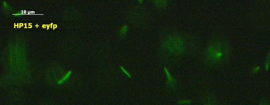Marine bacteria tagged with fluorescence are investigated in the laboratory for chemotaxis using a microscope. (Source: Constructor University) 